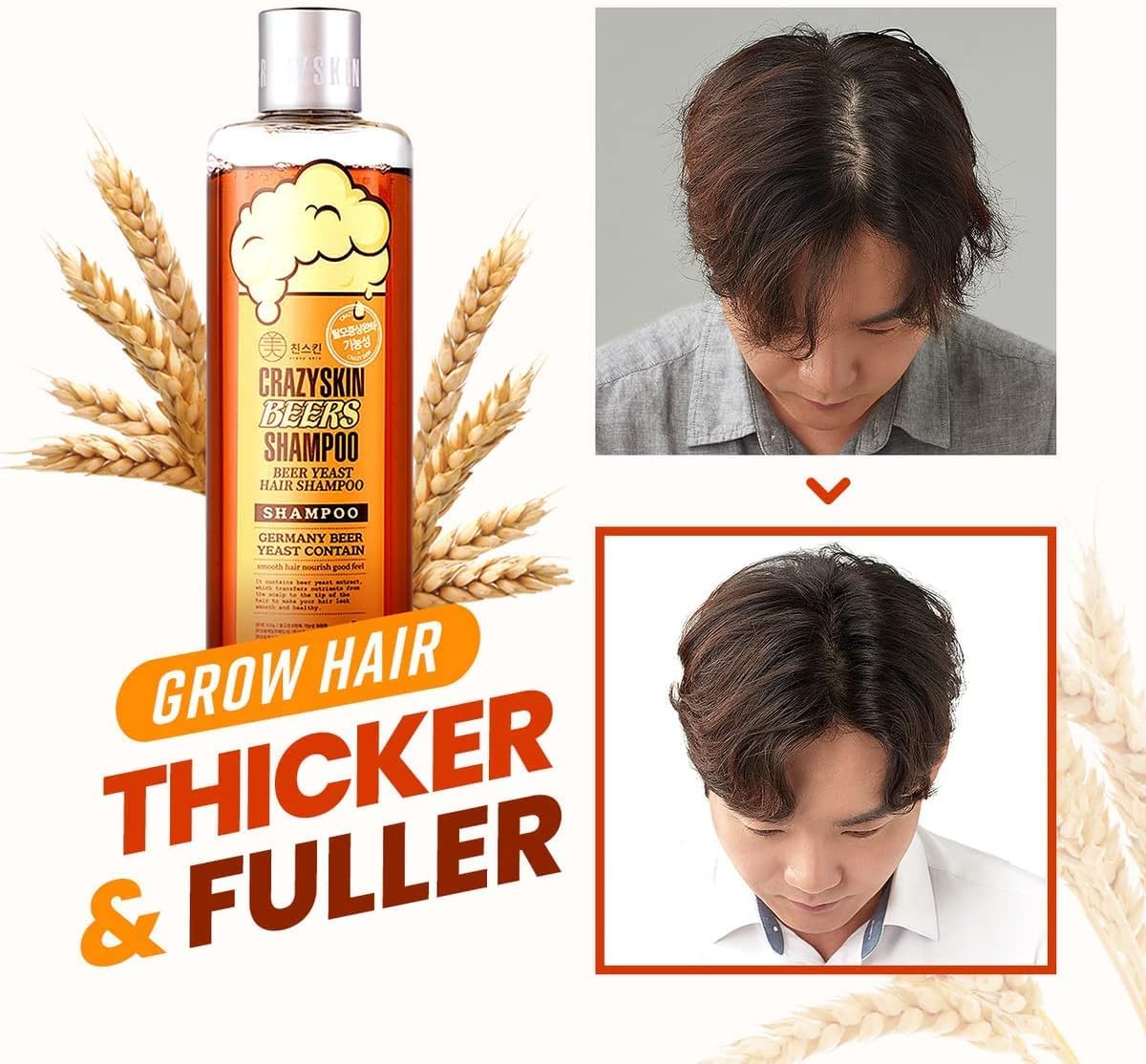 CRAZY SKIN BIOTIN shampoo for hair loss, Rich with Beer Yeast for Hair Regrowth and Thickening, thinning hair, Sulfate free,10.15 fl oz(300g)
